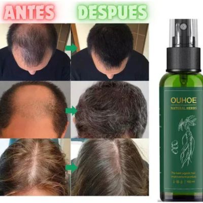 Activa el crecimiento desde la raíz con FollicX™ ❤️