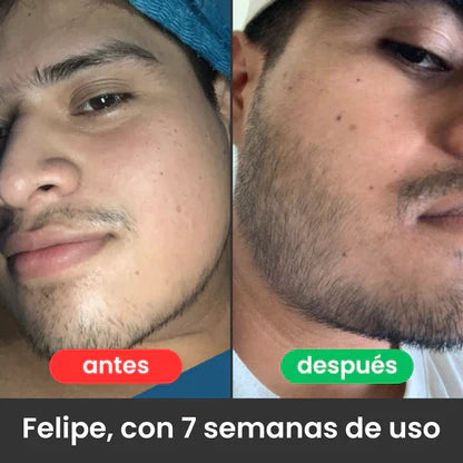 Bálsamo para Crecimiento de Barba Ultra Potente con Minoxidil 20% | 100mL 🔥
